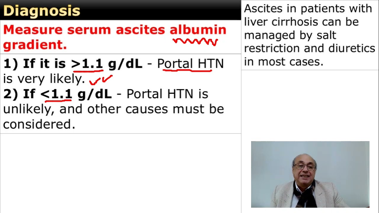 Ascites