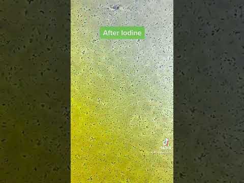 Bacteria VS Iodine under the microscope!
