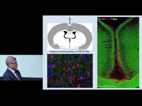 Prof. Richard Reynolds (Imperial College London) on grey matter atrophy in Multiple Sclerosis
