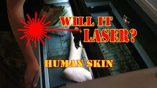 WILL IT LASER: Human Skin