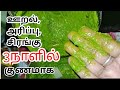 தோல் அலர்ஜி அரிப்பு ஊறல் குணமாக்கும்