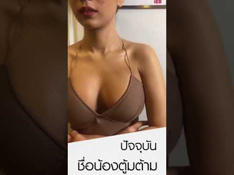 วิธีการเพิ่มเต้านม 15 ปี หน้าอกเล็กและหัวนม