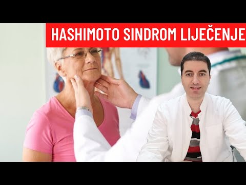 HASHIMOTO SINDROM (bolest štitnjače) - prirodno liječenje!