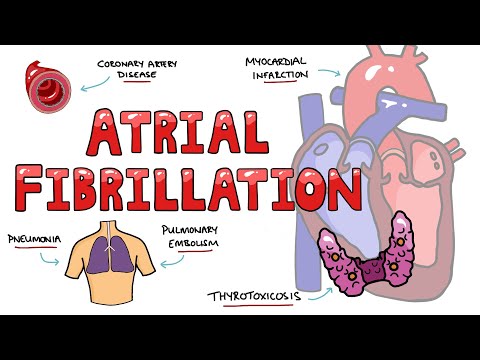 Systemic Lupus Erythematosus Signs and Symptoms SOAP BRAIN MD Mnemonic