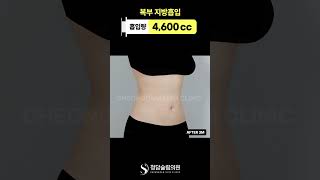 이게 진짜 내 배라고..? Before 사진있음