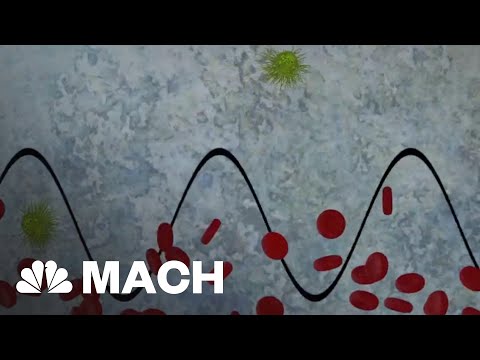 Using Sound Waves To Fight Cancer | Mach | NBC News