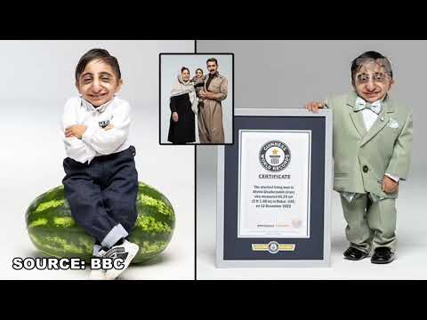 Top News - 20-vjeçari futet në Guinness / Zyrtarisht njeriu më i shkurtër në botë