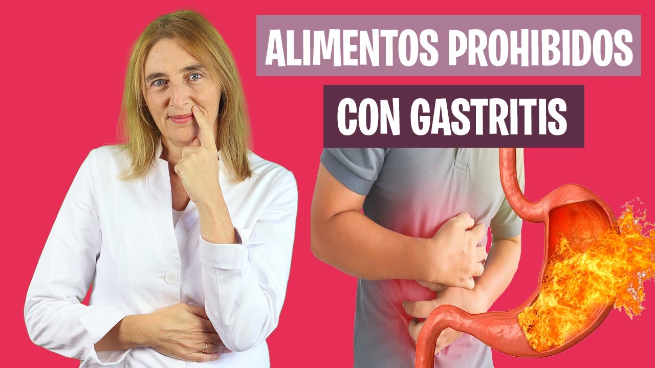 ALIMENTOS CONTRAINDICADOS en la GASTRITIS | Gastritis crónica y alimentación | Nutrición y Dietética