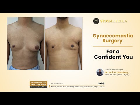 Gynaecomastia Treatment