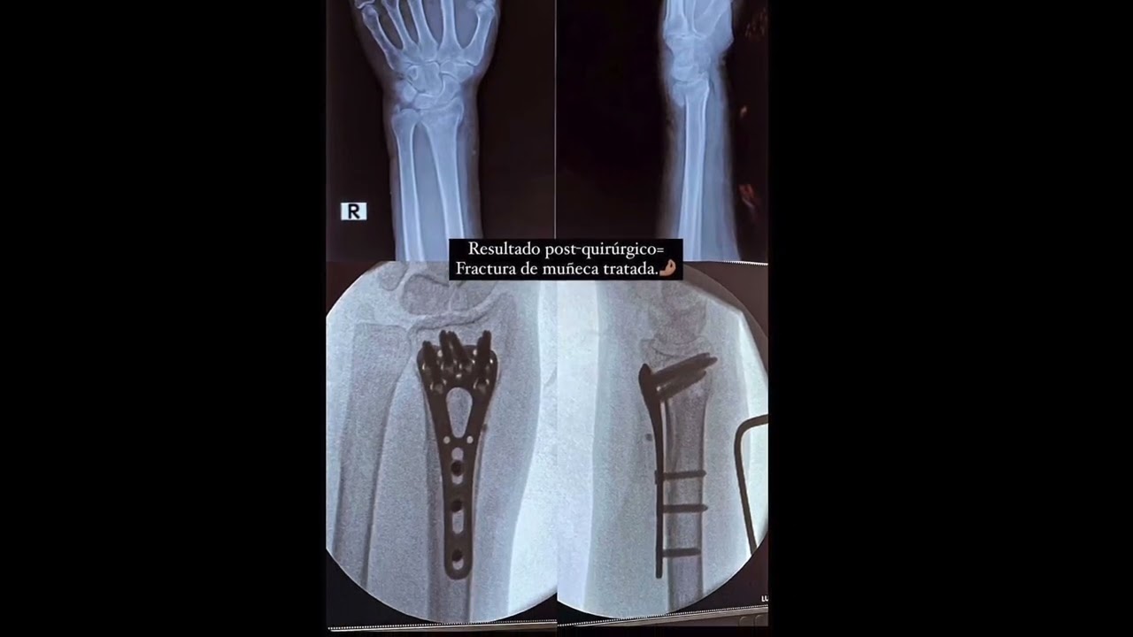 Carlos Eduardo Uribe Saloma-15