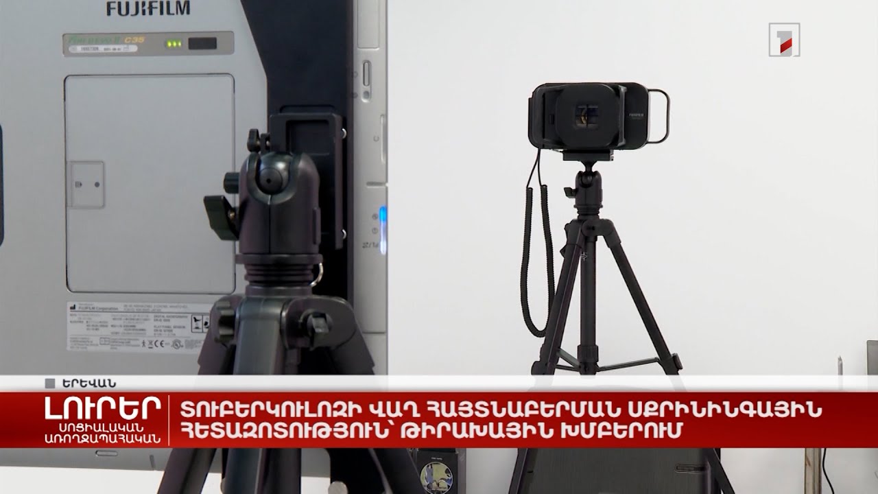 Տուբերկուլոզի վաղ հայտնաբերման սքրինինգային հետազոտություն՝ թիրախային խմբերում