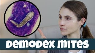 DEMODEX MITES ON YOUR SKIN| DR DRAY