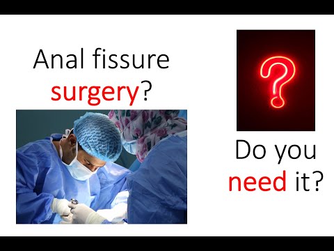 Surgery for your anal fissure?  You might NOT need it!