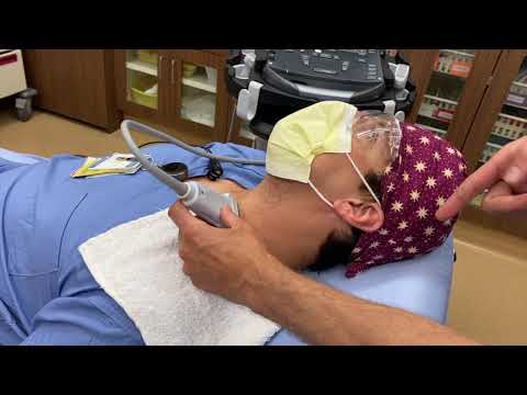 Supraclavicular Line