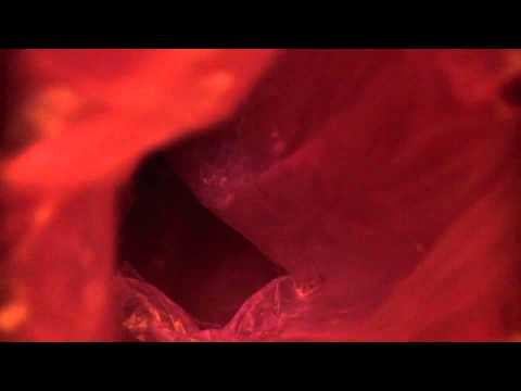 Dysfonia - Ostatni przystanek przed miasteczkiem niewoli