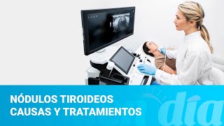 Nódulos tiroideos causas y tratamientos