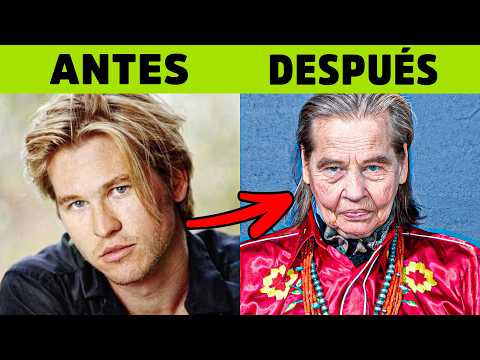 50 Celebrities Who Aged Badly - Then and Now