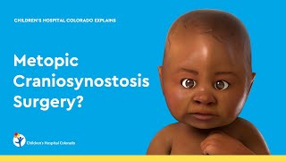 What is Metopic Craniosynostosis Surgery