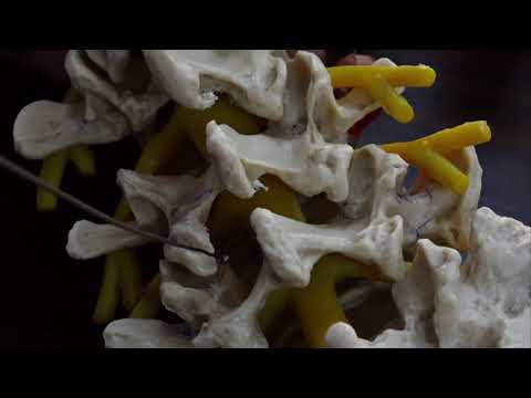 Surgical anatomy of minimal invasive lumbar discectomy by Dr Jayesh Sardhara