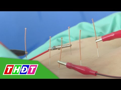 Bệnh thoát vị đĩa đệm là gì? Nguyên nhân, dấu hiệu và cách phòng tránh | THDT