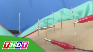 Bệnh thoát vị đĩa đệm là gì? Nguyên nhân, dấu hiệu và cách phòng tránh | THDT