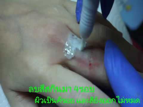 ครีมค้อนของ ธ อร์ผ่านเคาน์เตอร์ การออกกำลังกายเพิ่มความแข็งแรง