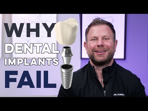 Why Dental Implants Fail
