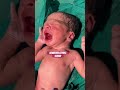 Newborn Crying Sound 🫠 Newborn Baby Shorts