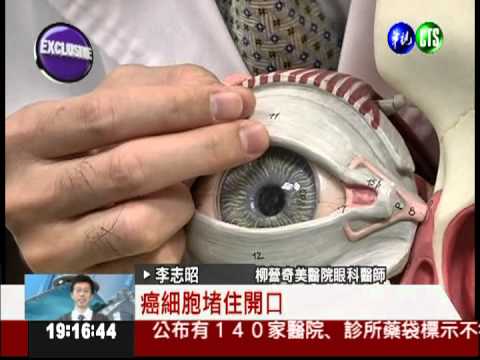 皮脂癌誤當針眼 延誤就醫險沒命!