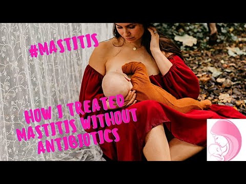 #MASTITIS how to treat and prevent without antibiotics