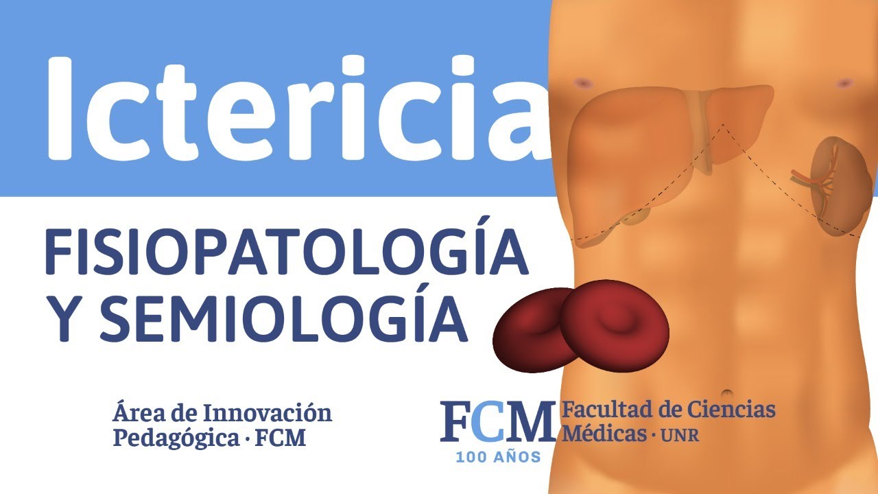 Ictericia - Fisiopatología y Semiología
