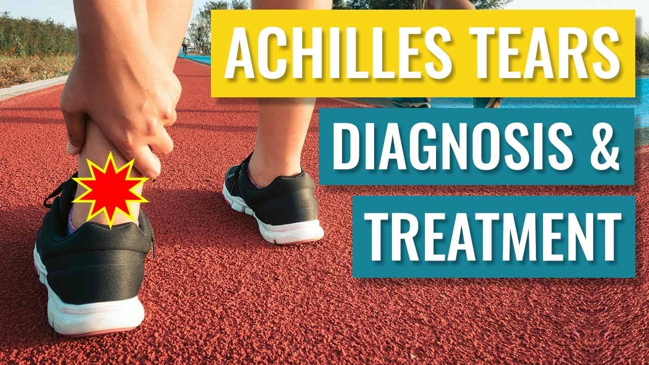 Achilles Tendon Tears - Diagnosis and Treatment of Complete Ruptures
