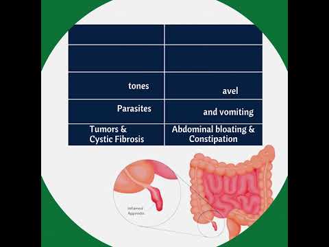 What is Appendicitis, Causes & Symptoms | Laparoscopic Appendectomy | Dr. Susenjit Prasad Mahato