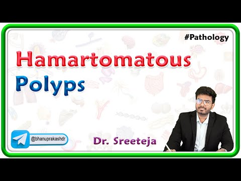13.  Hamartomatous Polyps (HPs) | USMLE Step 1 Pathology