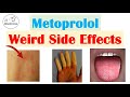 Metoprolol (& Beta Blockers) Weird Side Effects (Skin, Gastrointestinal, Psychological)