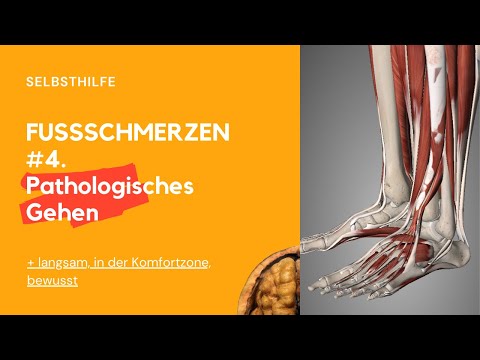 FUSS #4. Pathologisches Gehen. Wie geht man richtig und wie falsch.