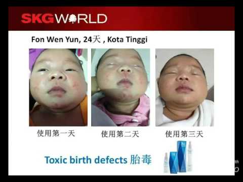 download lagu mp3 mp4 Skg World, download lagu Skg World gratis, unduh video klip Skg World