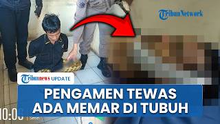 Diduga Tewas Tak Wajar, Keluarga Pengamen di Pasar Raya Padang Lapor Polisi: Ada Memar di Tubuh