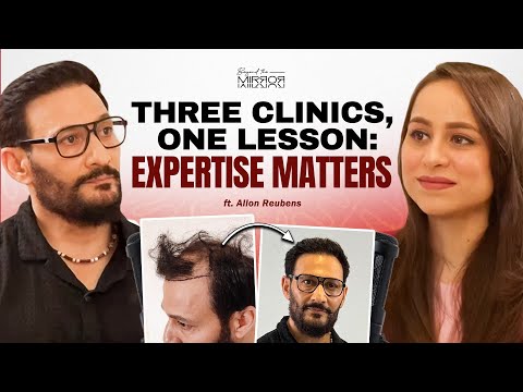 Allon Reubens on losing donor area across three failed procedures