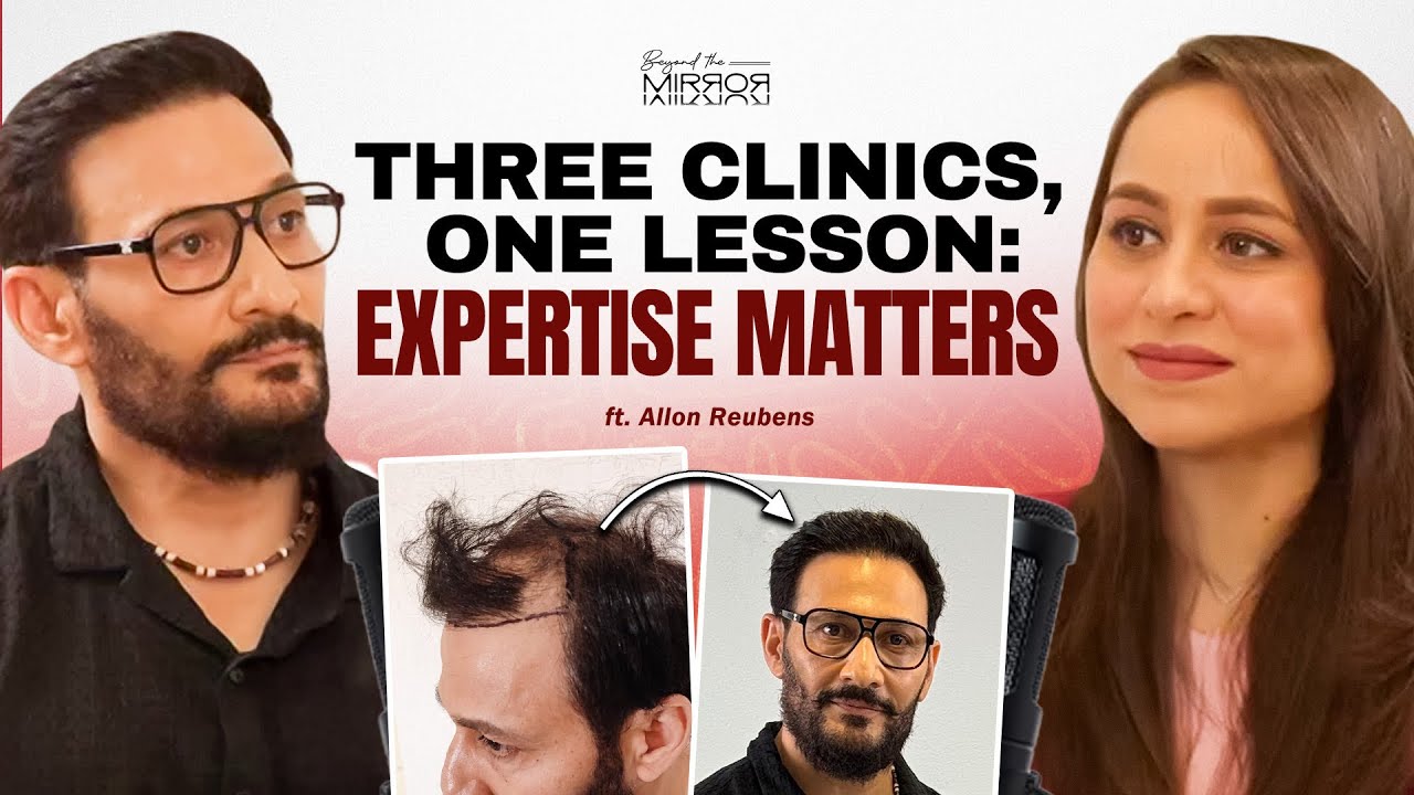 Allon Reubens on why his third hair transplant failed to grow, full interview