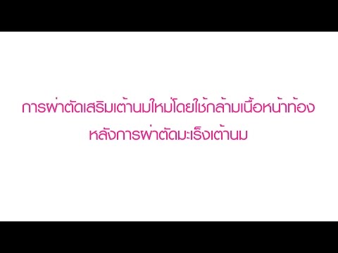 หน้าอกพลาสติกในความคิดเห็นของคาร์คอฟ วิธีการขยายขนาดหน้าอก