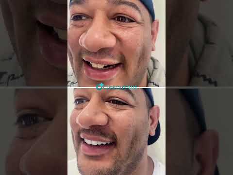 From USA to Istanbul: Demetri Forte’s Hollywood Smile with Zirconium Crowns | CLINIQUEPLUS