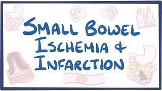 Small bowel ischemia & infarction - causes, symptoms, diagnosis, treatment, pathology