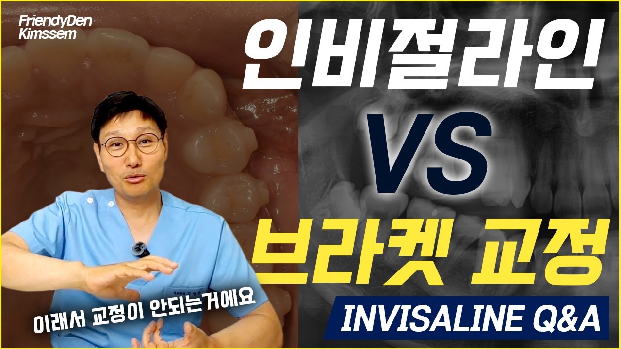 #인비절라인 , 발치교정 + 골격성 부정교합도 가능할까? (#발치교정 #클린첵 #주걱턱교정 #인비절라인치과)