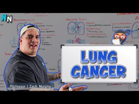 Lung Cancer | Clinical Medicine