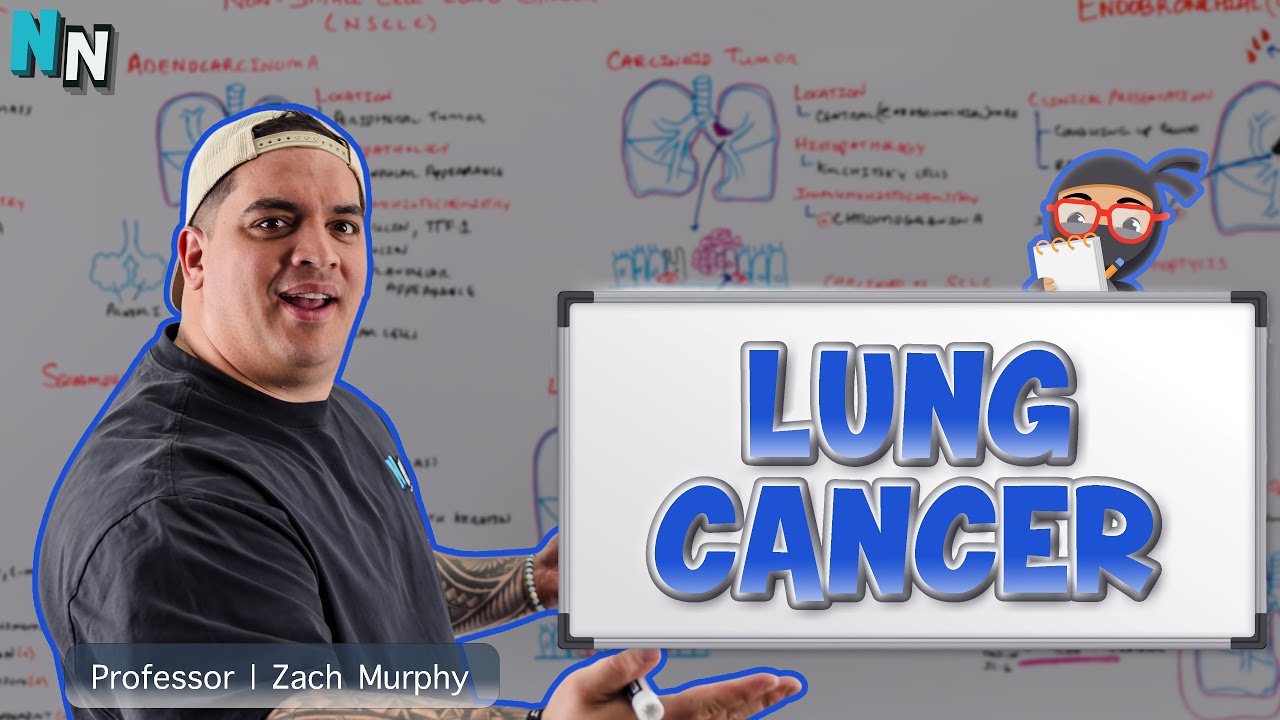 Lung Cancer | Clinical Medicine