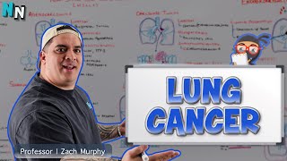 Lung Cancer | Clinical Medicine
