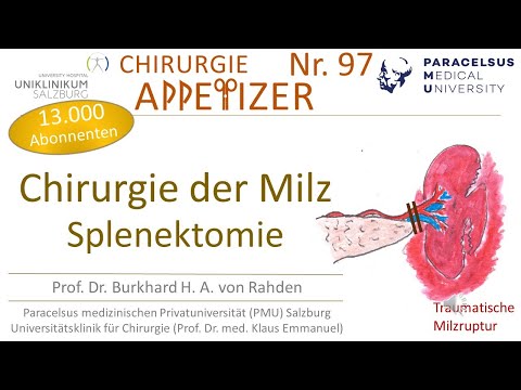 Spleen Surgery Splenectomy SURGERY APPetizer No. 97