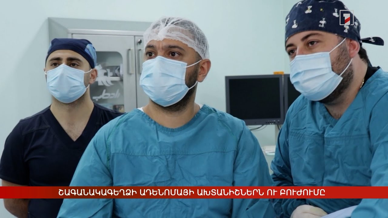 Շագանակագեղձի ադենոմայի ախտանիշներն ու բուժումը