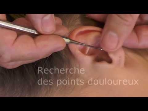 comment soigner eczema oreilles